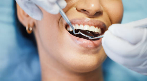 Best Emergency Dentist for Lost Fillings or Crowns in Lyons, WI