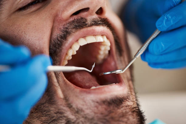 Best Emergency Dentist for Knocked-Out Tooth in Lyons, WI